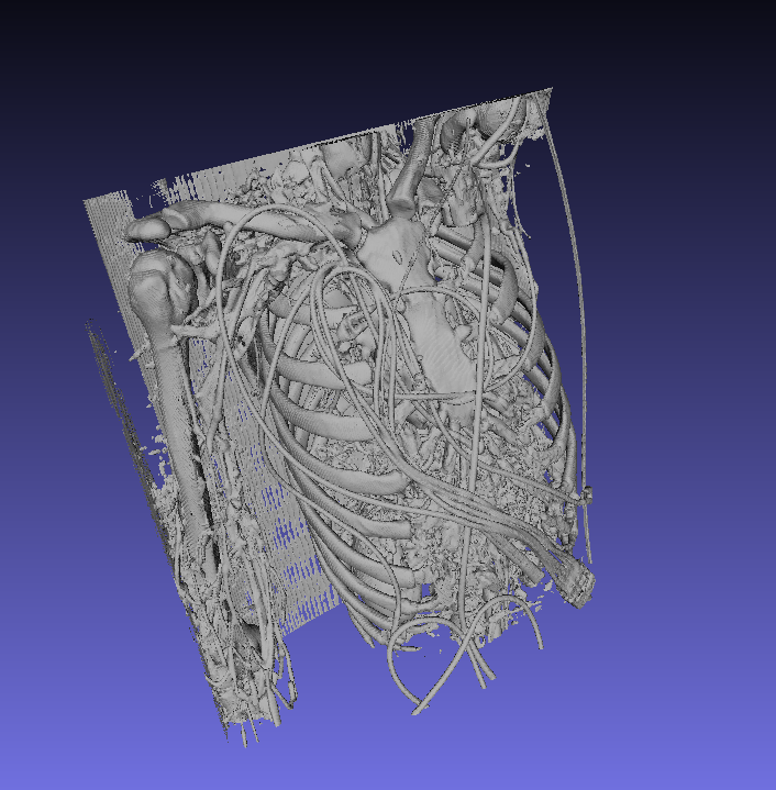 CTA Cardio Image