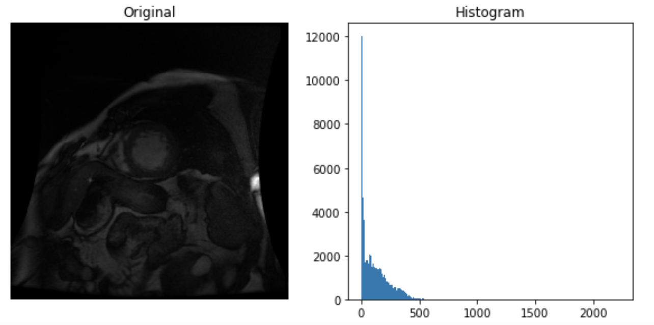 corresponding dicom